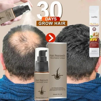 צמיחת שיער ג ' ינג ' ר סרום ספריי חזק נגד נשירת שיער, מוצרים לטיפול לתקן ולהזין את שורשי השיער מהר לצמיחה מחודשת שיער גברים נשים